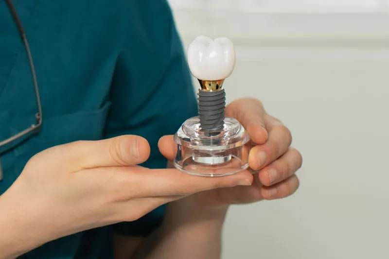 Dentist holding a dental implant in his hands