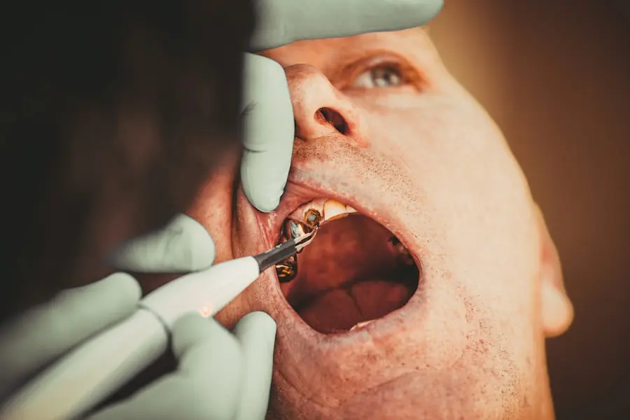 dental bonding