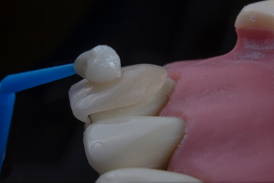 Photo veneer shaving teeth