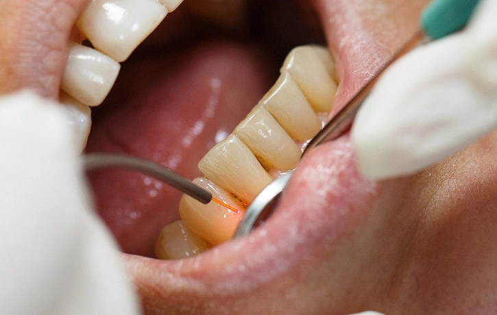 Dr howard performing a bad breath treatement in miami beach florida.webp