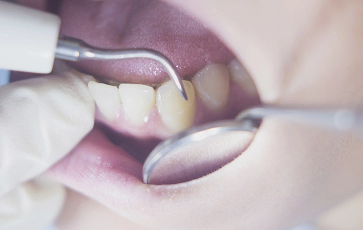 Dr howard performing a bad breath treatement miami fl.webp