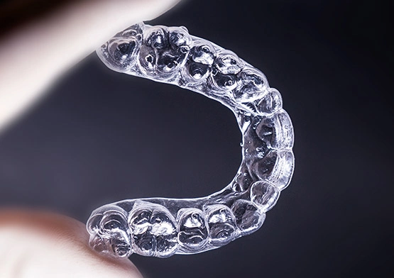Invisalign in miami beach florida.webp