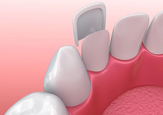 Lumineers in miami beach florida.webp