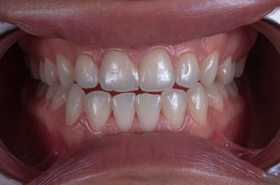 cosmetic family dentistry