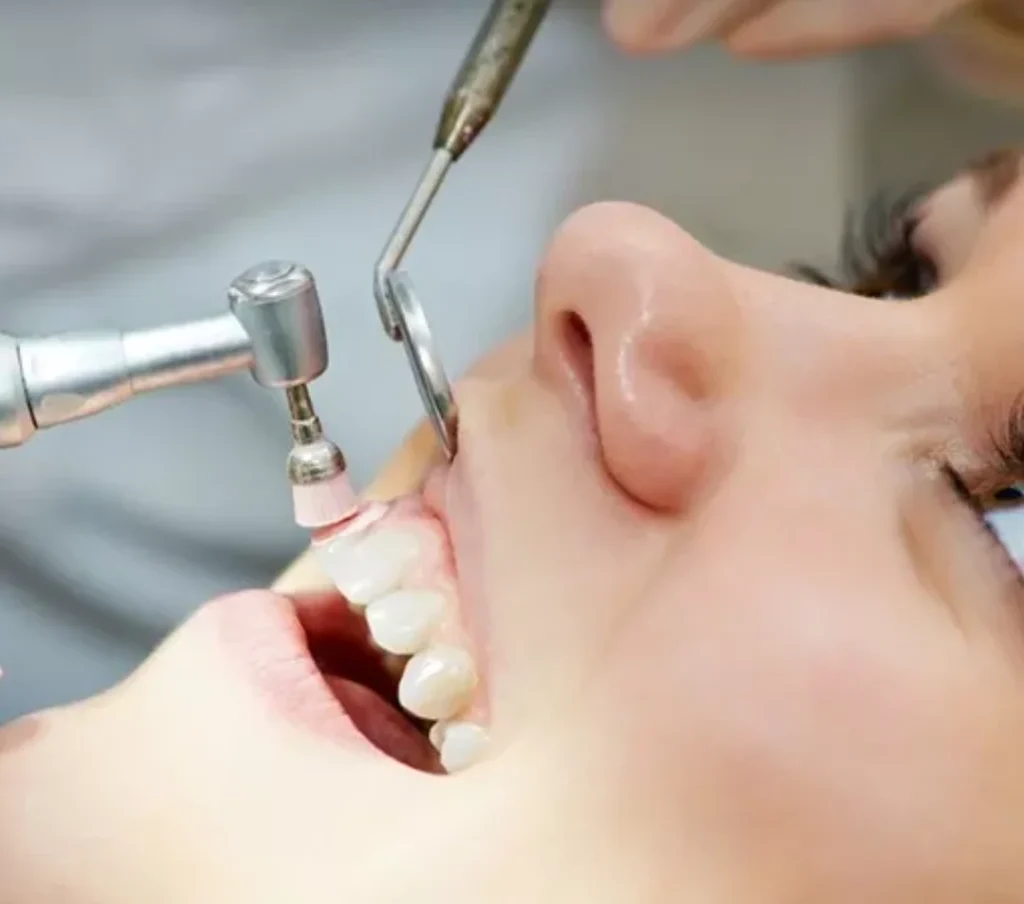 dental cleaning.webp