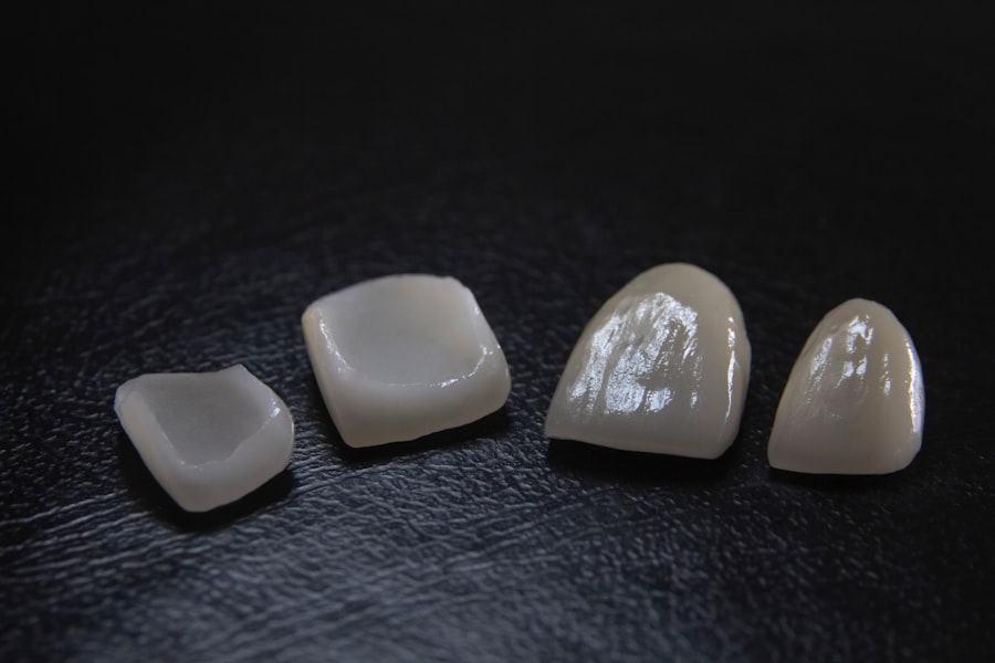 Photo veneers